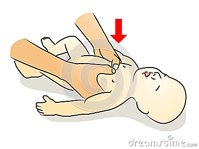 CPR baby by 2 thumbs. Vector Illustration
