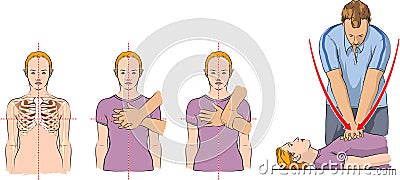 CPR demonstration Vector Illustration