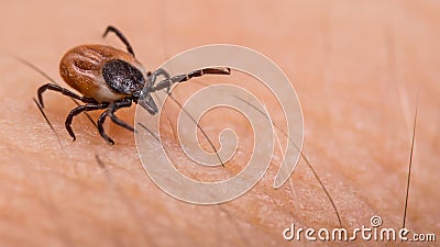 Crawling deer tick on human hairy skin background. Ixodes ricinus or scapularis Stock Photo