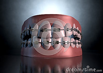 Creepy Teeth With Braces Stock Photo