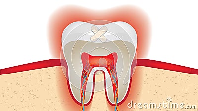 Crop of molar tooth adhesive plaster Vector Illustration