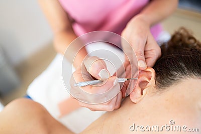 Auriculotherapy treatment on female ear with flexible massage brass ear pen Stock Photo