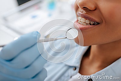 View of orthodontist in latex glove holding dental mirror near happy african american patient in braces Stock Photo