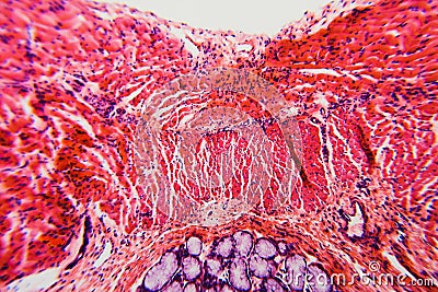 Cross section esophagus dog Stock Photo