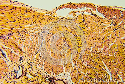 Cross section esophagus dog Stock Photo