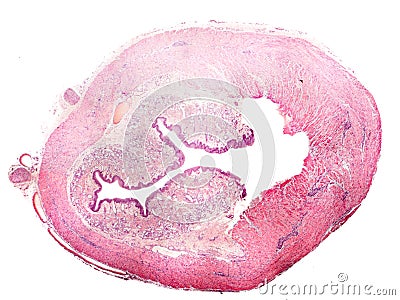 Cross-section of human esophagus Stock Photo