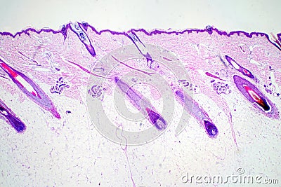 Cross section human skin head under microscope view for education histology. Stock Photo