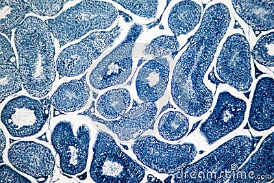 Cross section Human testis under microscope view. Stock Photo