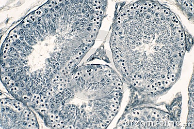 Cross section Human testis under microscope view Stock Photo