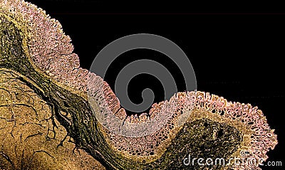 Cross section of a normal stomach showing pyloric mucosa Stock Photo