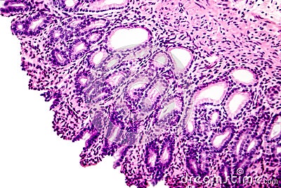 Cross section of stomach Stock Photo