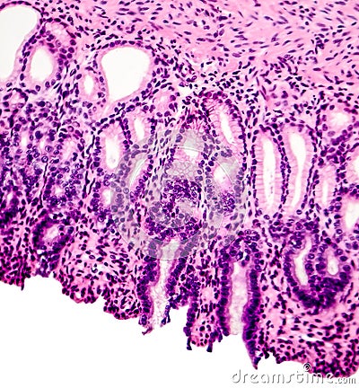 Cross section of stomach Stock Photo