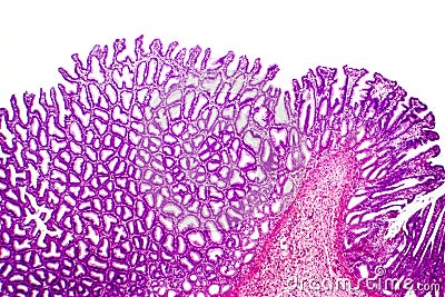 Cross section of stomach. Light micrograph showing stomach epithelium Stock Photo