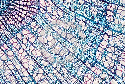 Cross section - Xylem is a type of tissue in vascular plants that transports water and some nutrients Stock Photo