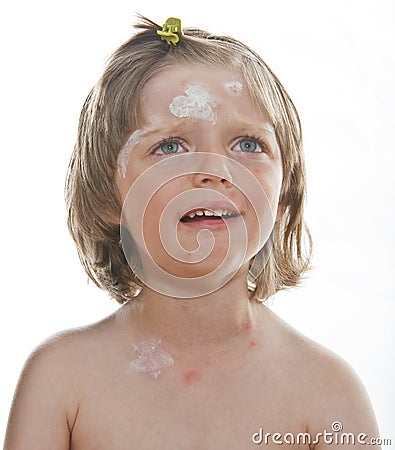 Crying little girl with smallpox Stock Photo