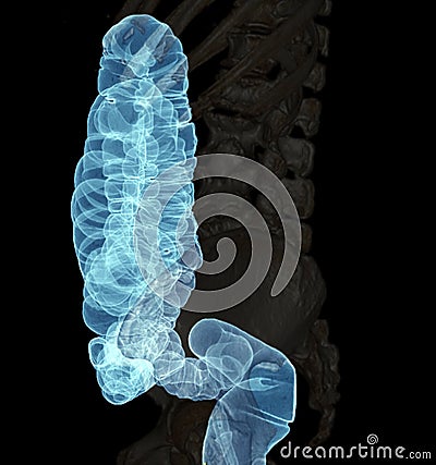 CT colonography or CT Scan of Colon 3D Rendering image lateral view. Stock Photo