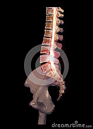 CT Lumbar spine or L-S spine 3D rendering image sagittal view 3D rendering . Clipping path Stock Photo