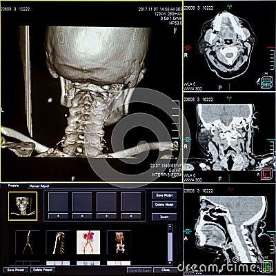 CT scans of human head Stock Photo