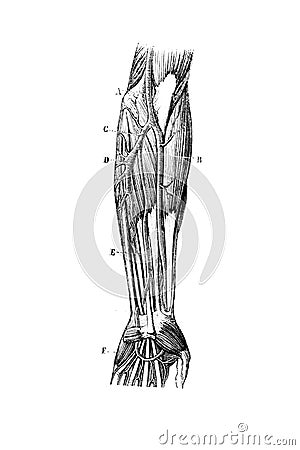 Cubital artery abnormality in the old book D`Anatomie Chirurgicale, by B. Anger, 1869, Paris Stock Photo