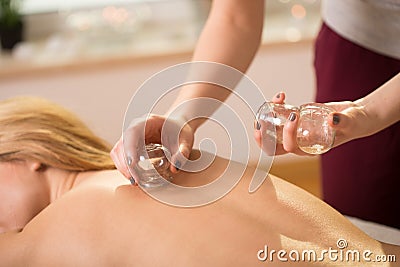 Cupping therapy Stock Photo