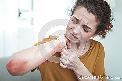 Curly woman feeling painful having rash and reddening on arm Stock Photo