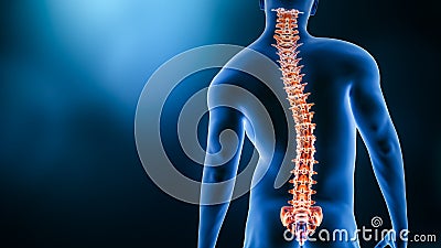 Curvature of the spine and man body back view 3D rendering illustration with copy space. Spine disorder or deformity, scoliosis, Cartoon Illustration