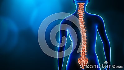 Curvature of the spine and woman body back view 3D rendering illustration with copy space. Spine disorder, scoliosis, backbone Cartoon Illustration