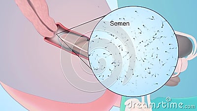 3D Animation of Penis and Vagina Incorporation Stock Footage - Video of menstruation, conception: 119048108 3D Animation of Penis and Vagina Incorporation Stock Footage - Video of menstruation, conception: 119048108