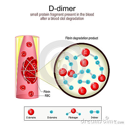 D-dimer formation. Blood vessel with blood clot Vector Illustration