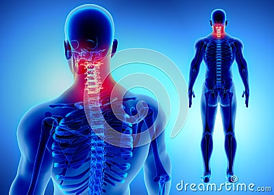 3D illustration of Cervical Spine, medical concept. Cartoon Illustration