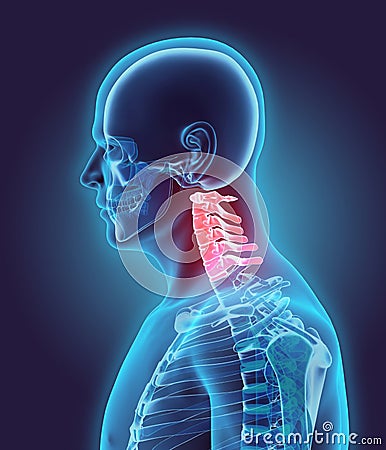 3D illustration of Cervical Spine, medical concept. Cartoon Illustration