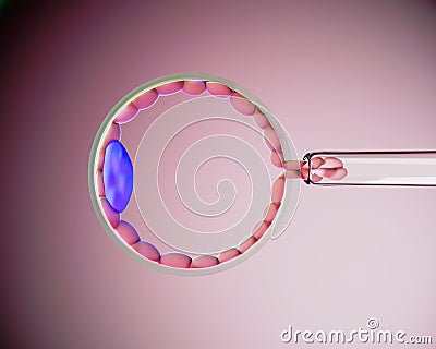 3D illustration of human blastocyst biopsy. PGT-A?Preimplantation genetic testing for aneuploidy) Cartoon Illustration