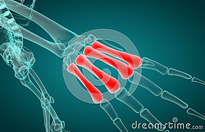 3D illustration of of metacarpal x-ray Cartoon Illustration