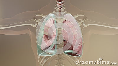 3d Illustration of Pneumothorax, Normal lung versus collapsed Stock Photo