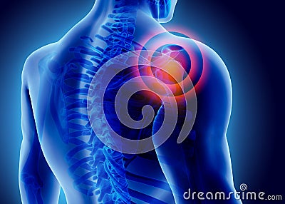 3D Illustration of shoulder painful. Stock Photo