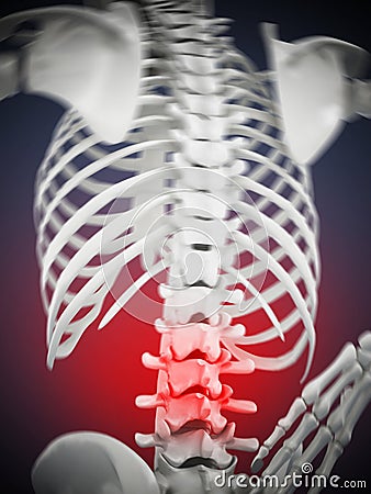 3D illustration showing back pain. 3D illustration Cartoon Illustration