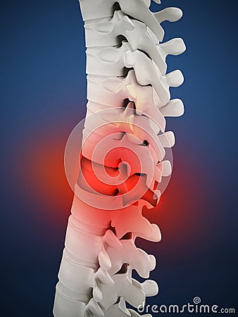 3D illustration showing back pain. 3D illustration Cartoon Illustration