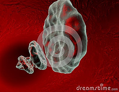 3d Infected blood vein Stock Photo