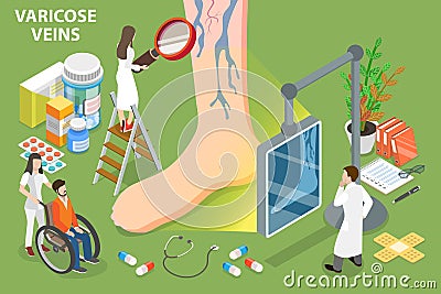 3D Isometric Flat Vector Conceptual Illustration of Varicose Veins Vector Illustration