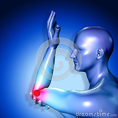 3d medical figure having pain in injured elbow Stock Photo