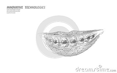 3D orthodontic braces. Wonam smile tooth trainer. Dental theatment heath care medical banner. Low poly design dentist Vector Illustration