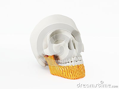 3d printed jaw Stock Photo