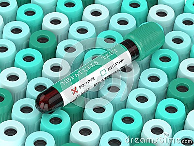 3d render of blood samples with hepatitis test Stock Photo