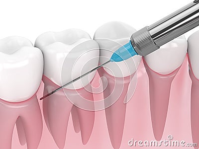 3d render of gums and syringe with dental anesthesia Stock Photo