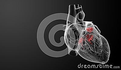 3d render Heart valve Stock Photo