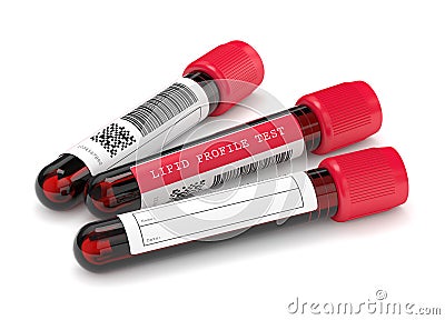 3d render with lipid profile test blood samples Stock Photo