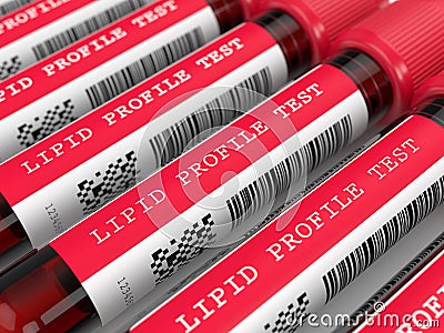 3d render with lipid profile test blood samples Stock Photo