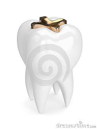 3d render of tooth with dental golden inlay filling Stock Photo