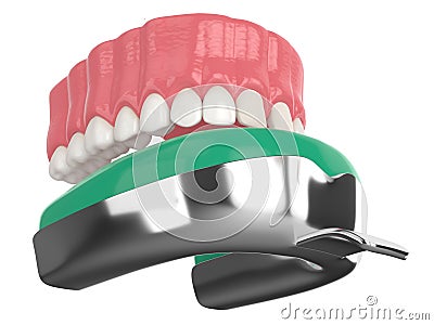 3d render of upper jaw with dental impression tray Stock Photo