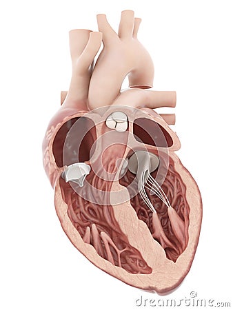 An artificial heart valve Cartoon Illustration